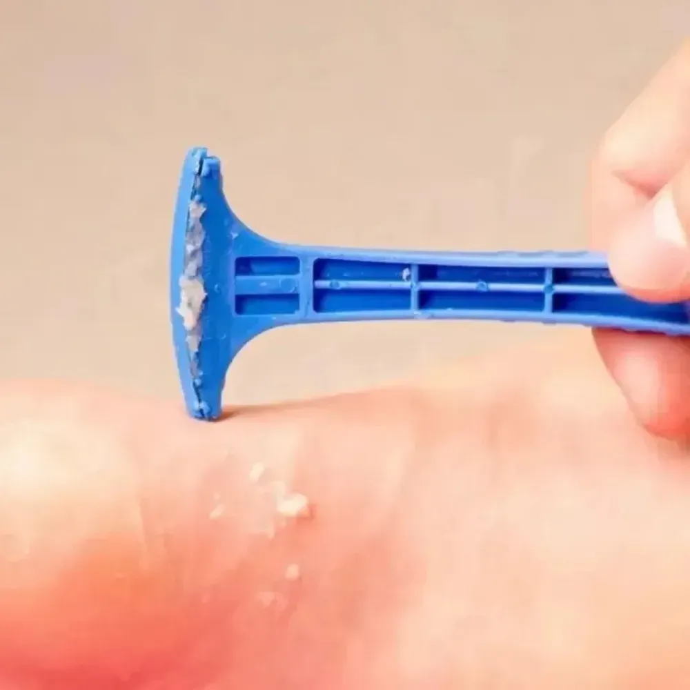 Lot de 2 Râpes à Pieds Portables en Plastique pour Éliminer les Callosités et Peaux Mortes 3