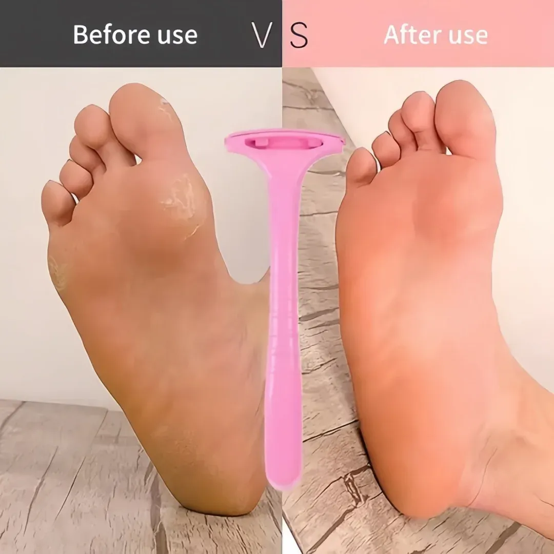 Détail du manche incurvé de la râpe à pieds