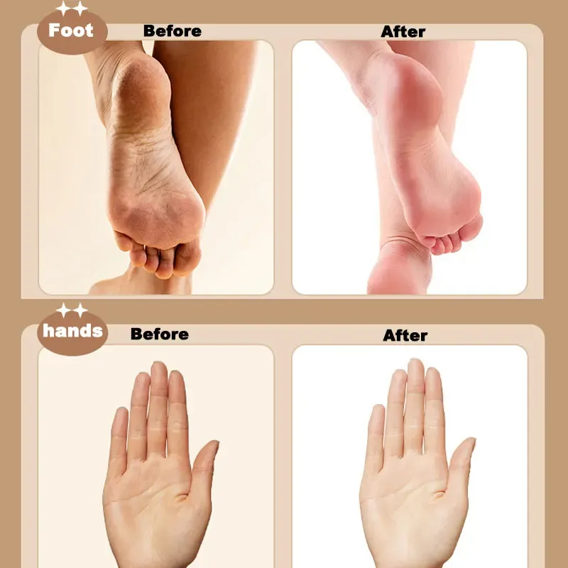 Lime électrique 3 en 1 pour pieds, éliminateur de callosités et peaux mortes, outil de soin des pieds, rechargeable, 3 vitesses 3