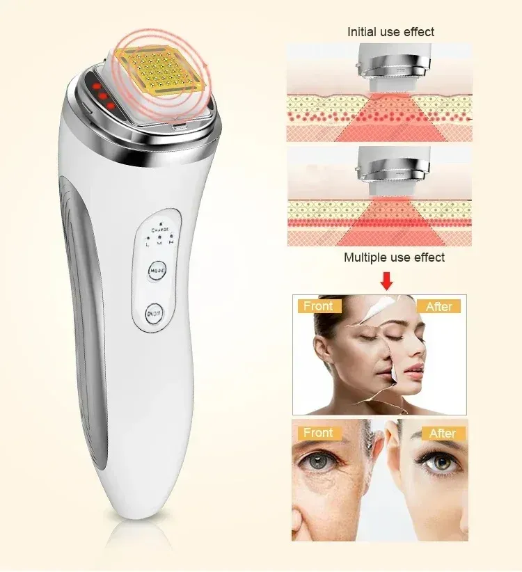 Appareil électrique de lifting facial à matrice de points, raffermissement de la peau, anti-rides et rajeunissement, masseur facial, appareil de beauté pour usage domestique 3