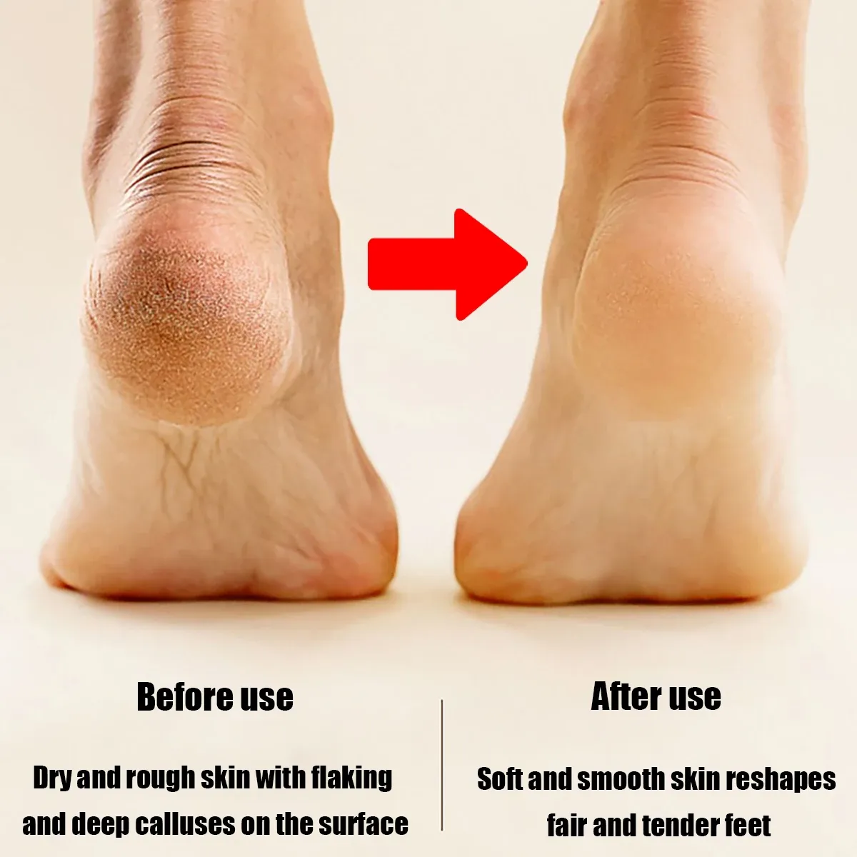 Soin des pieds à domicile