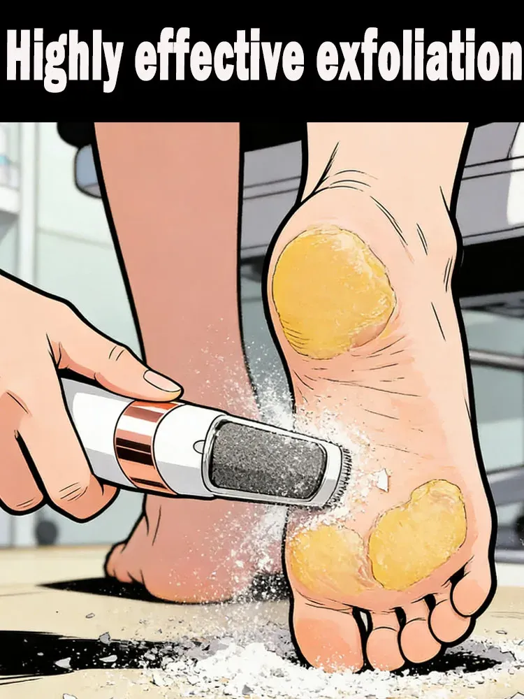 Lime électrique pour les pieds, élimine les callosités et les peaux mortes, mixte - Image 1