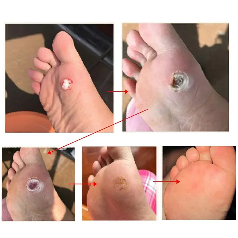 Confort quotidien au pied