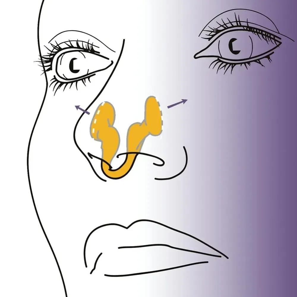 Dilatateur nasal en silicone, finition