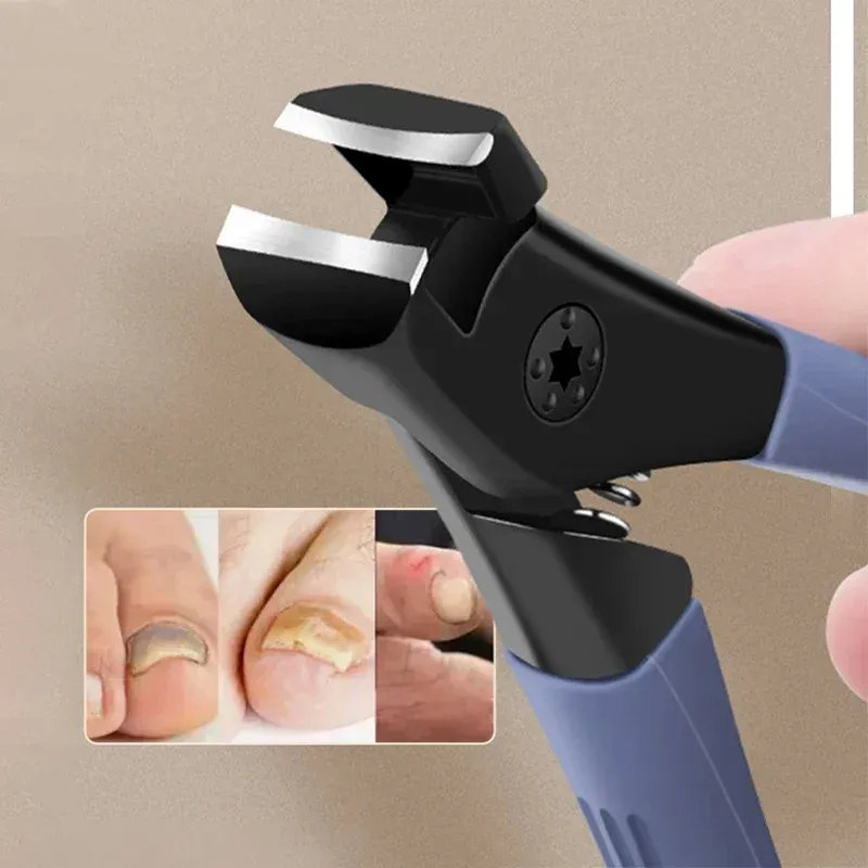 Coupe-ongles anti-éclaboussures, vue d'ensemble du design