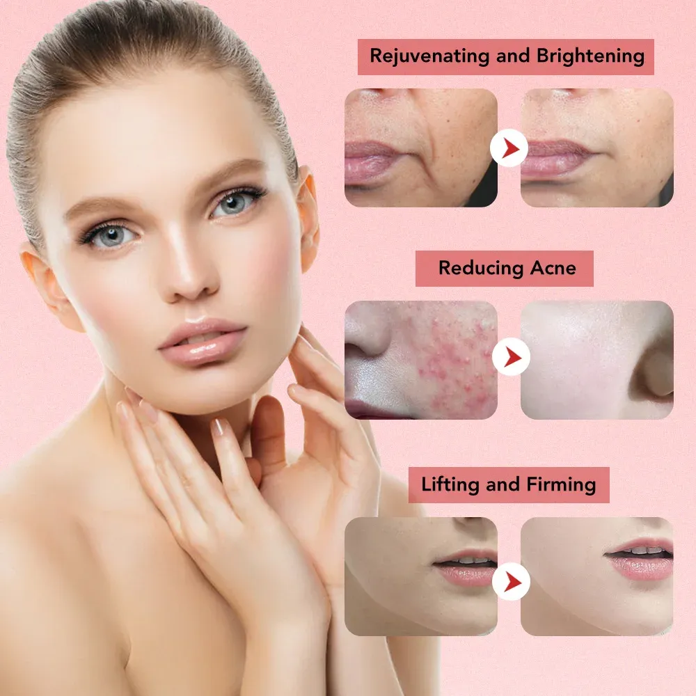 Massage chaud du visage avec l'appareil