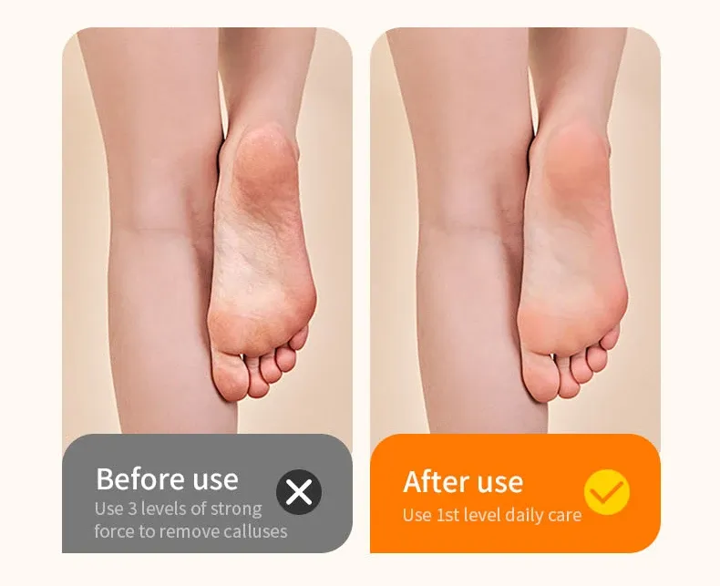 Ponceuse électrique pour pieds en situation
