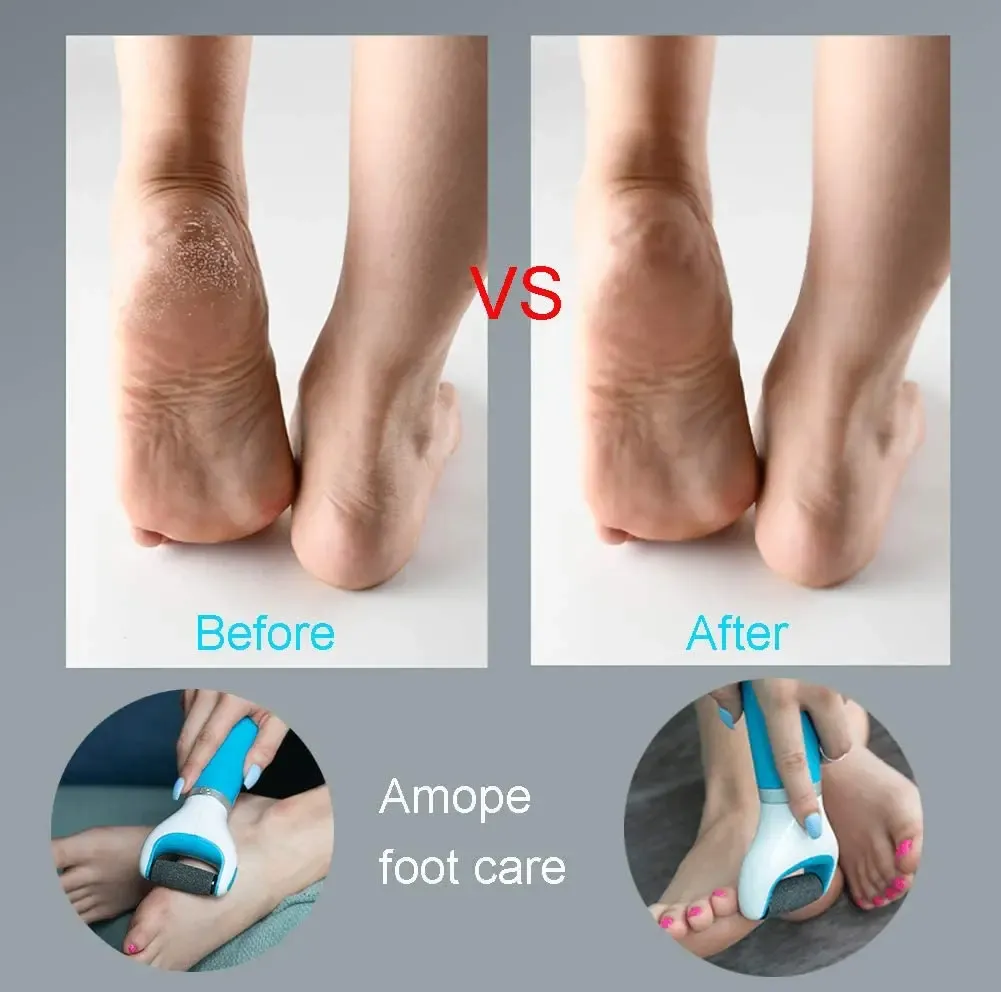 Lime électrique pour les pieds : élimination douce des callosités et de la peau morte, sans douleur 6