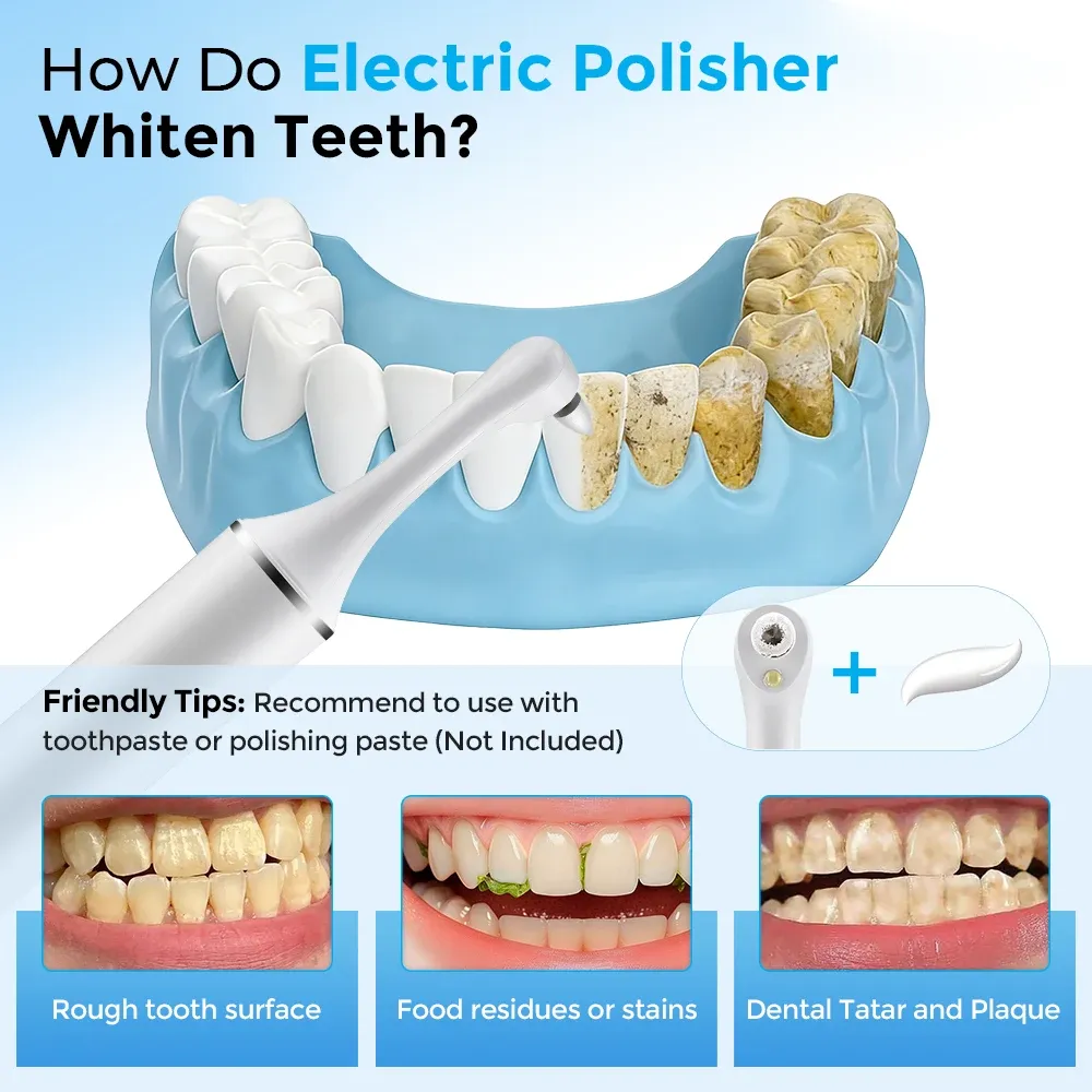 Polisseuse électrique pour dents, détail des têtes interchangeables