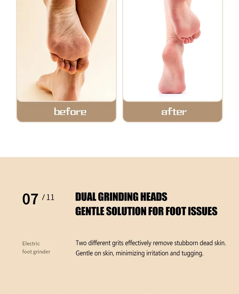 Appareil de soin des pieds, présentation produit
