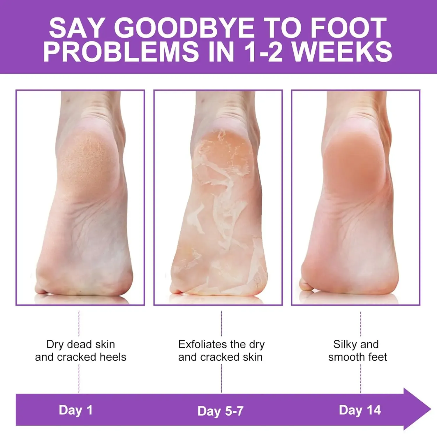 Masque exfoliant pour les pieds