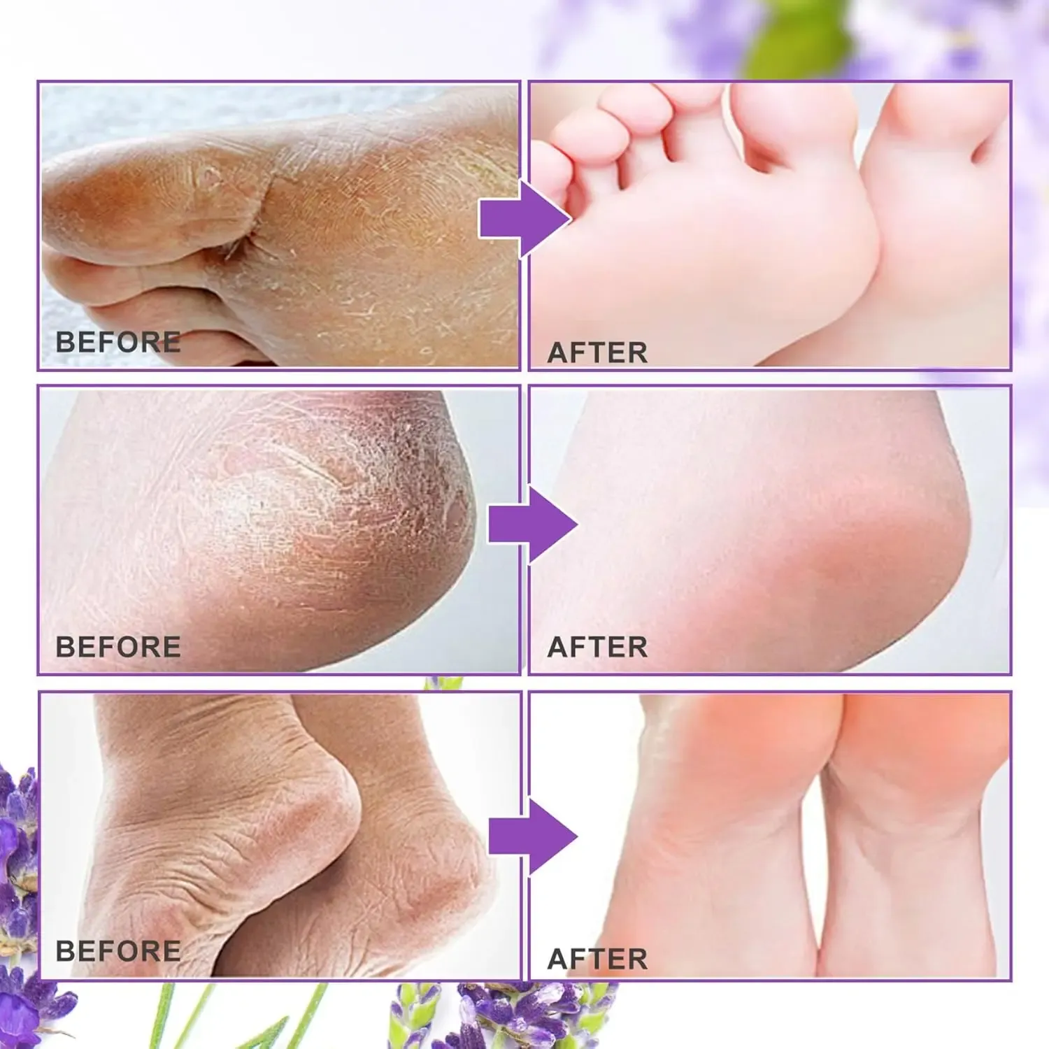 Masque exfoliant pour les pieds