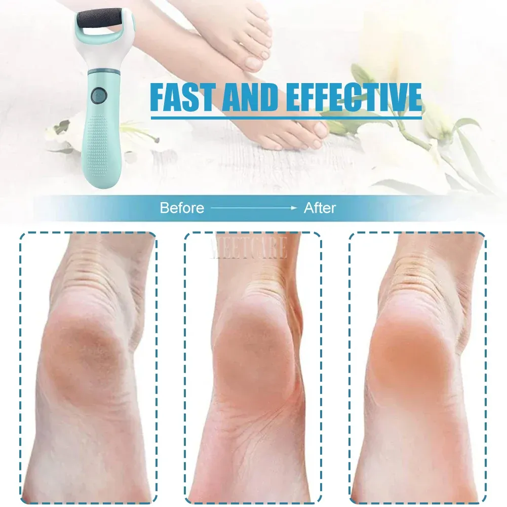 Ponceuse électrique pour pieds, élimine les peaux mortes et callosités 5