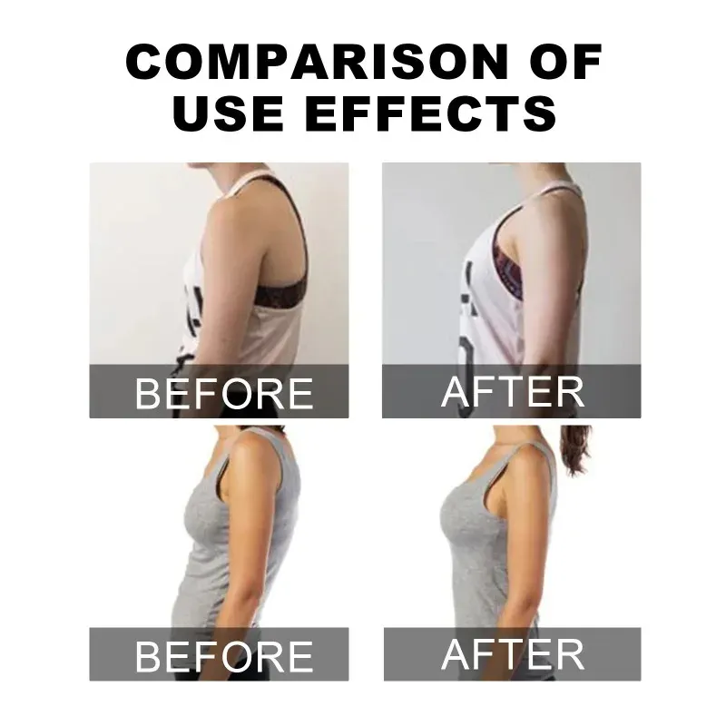 Ceinture de posture, vue d'ensemble