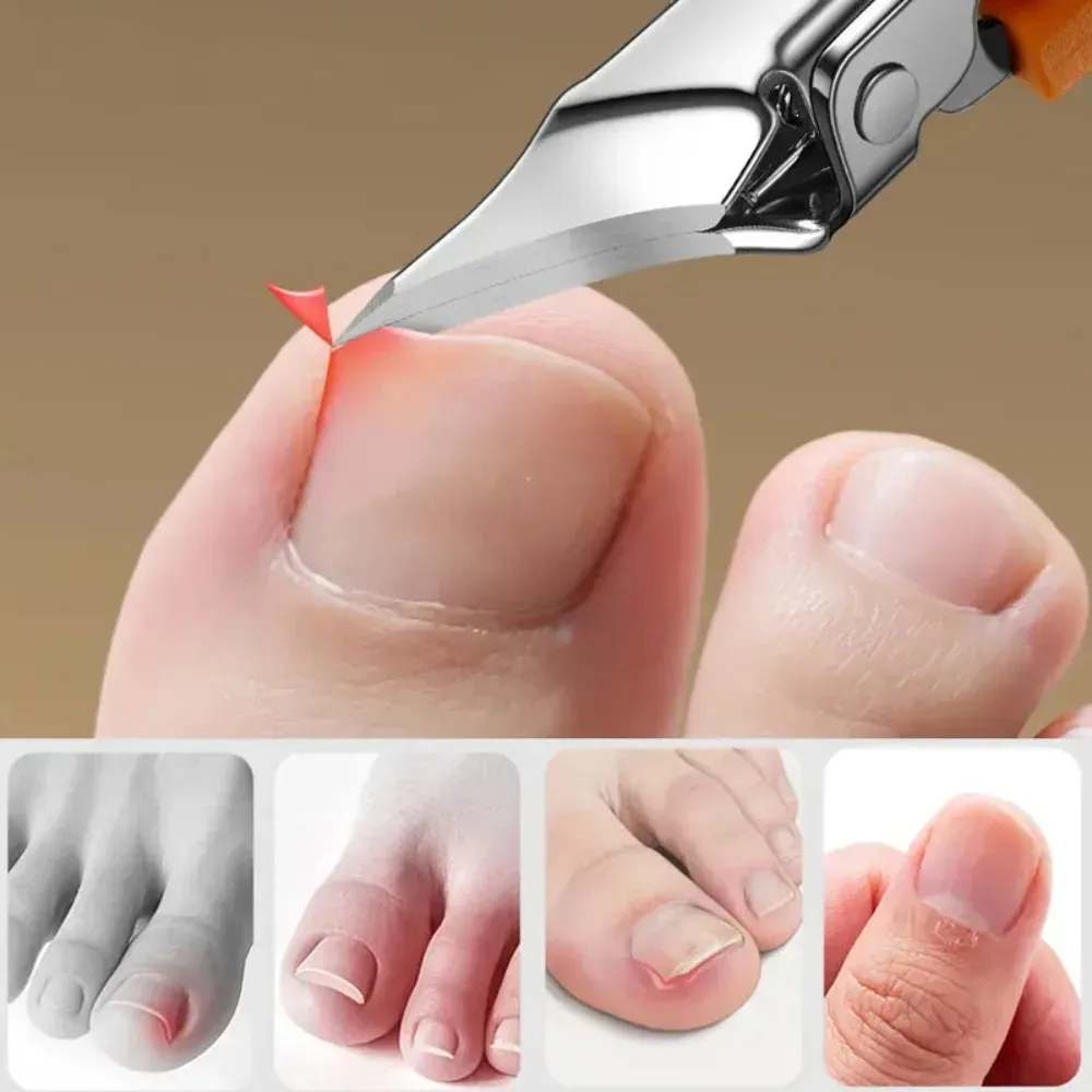 Coupe-ongles à bord incliné, large ouverture en acier inoxydable, outils professionnels pour ongles incarnés, bec d'aigle, coupe-ongles obliques 6