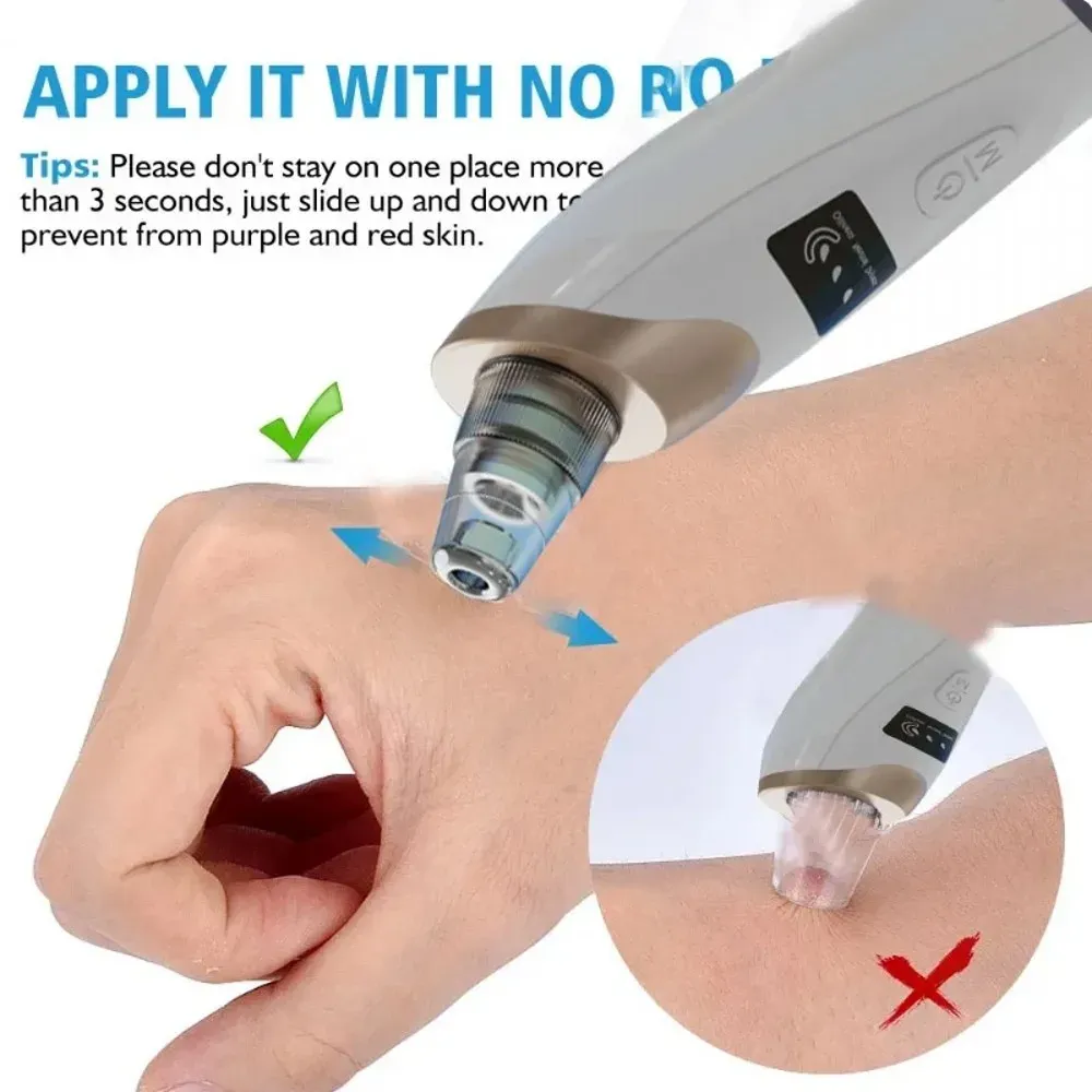 Appareil d'aspiration des points noirs, utilisation