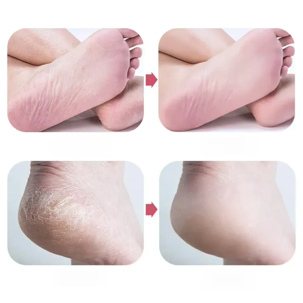 Outil de soin des pieds : couteau de pédicure, lime en verre nano, éliminateur de callosités, polisseur de talons 2