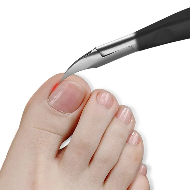 Coupe-ongles incarnés en acier inoxydable, ciseaux de manucure et pédicure pour cuticules et orteils 2