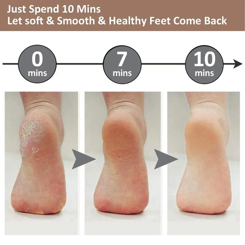 Râpe électrique rechargeable pour pieds, élimination des callosités et de la peau sèche 2