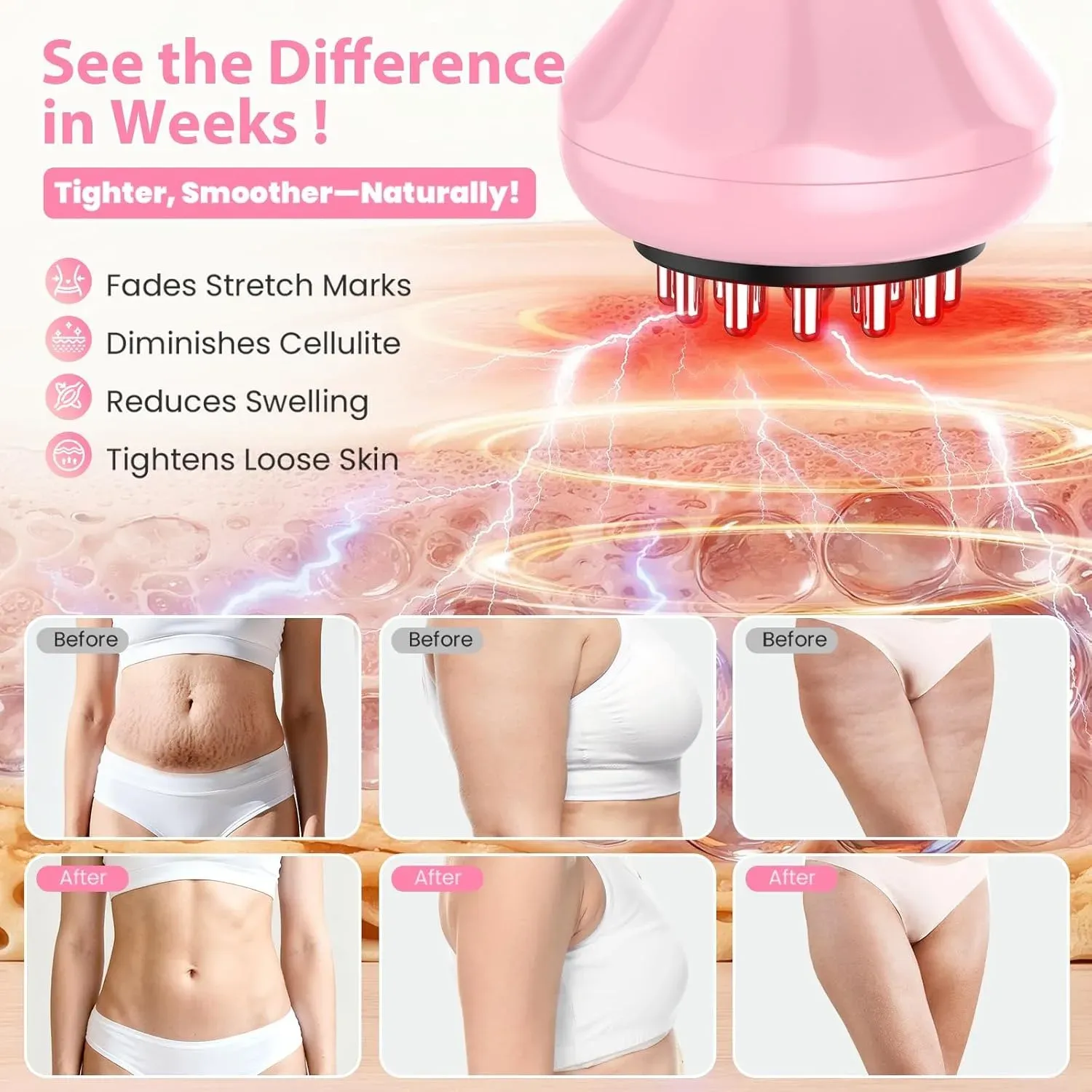 Brosse électrique pour méridiens, 9 niveaux de vibration, masseur corporel, remodelage, réduction des vergetures, cellulite, relaxation musculaire, outil de massage 2