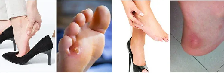 Coussinets anti-callosités pour le dos des pieds, vue d'ensemble