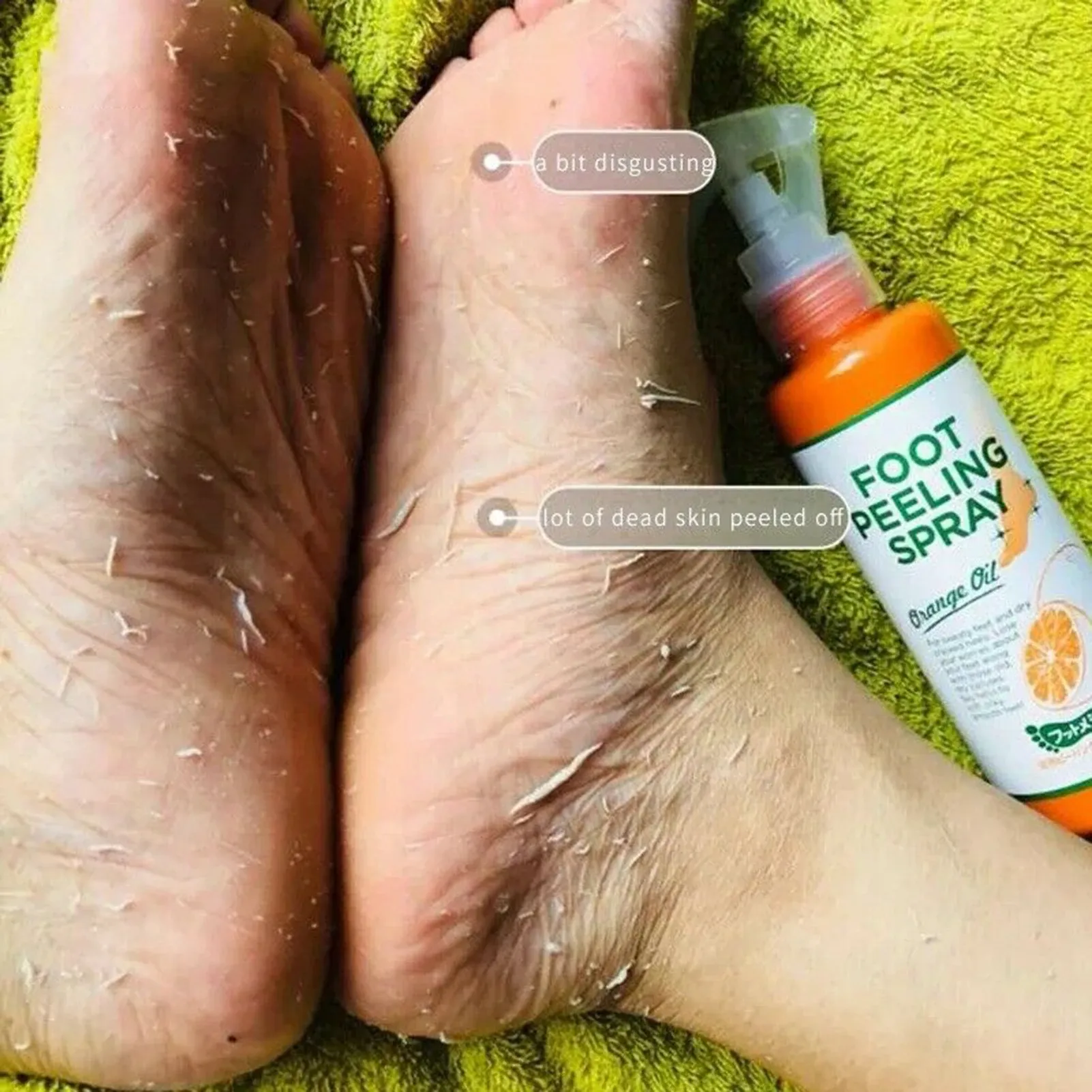 Exfoliant et Adoucissant pour Cuticules des Pieds 100 ml, Élimine les Peaux Mortes et les Callosités