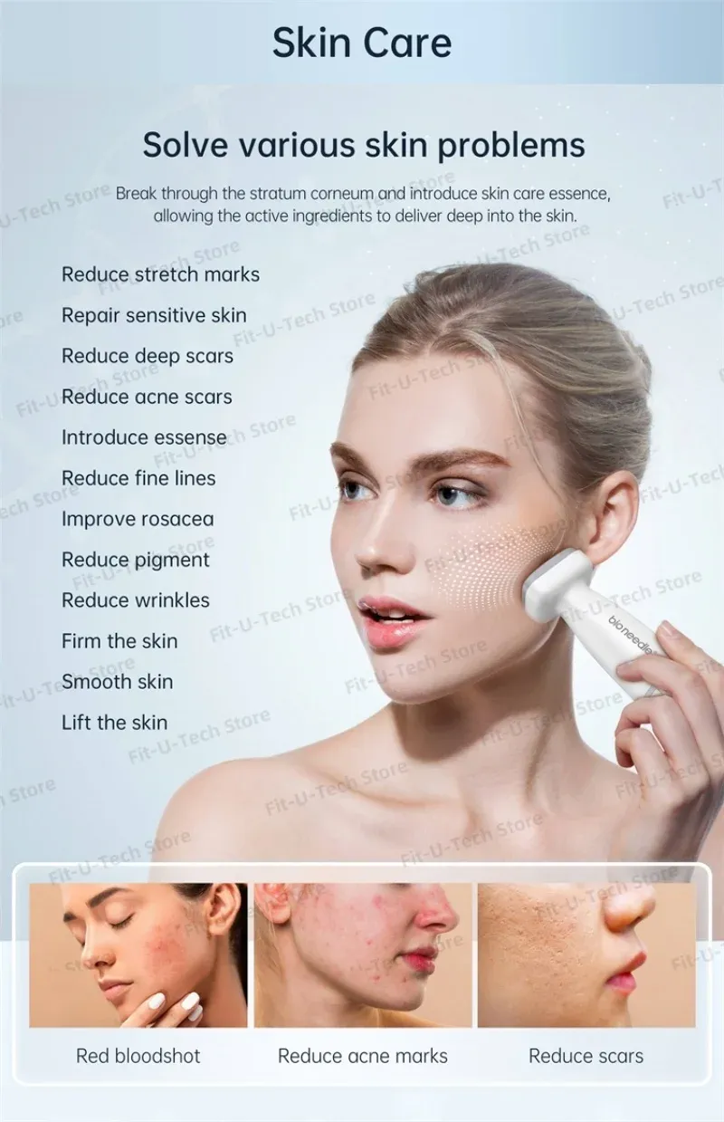 Détail du rouleau dermique