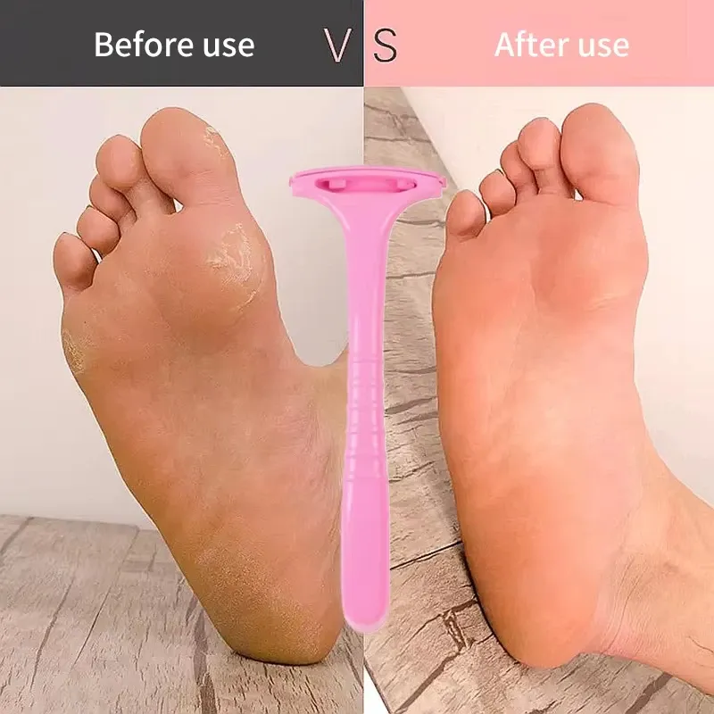 Râpe à callosités pour talons avec manche, éliminateur de peaux mortes en plastique portable 2