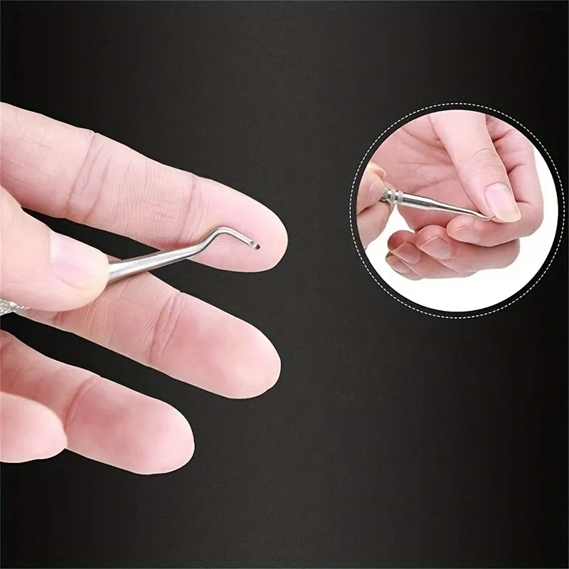 Pince à ongles incarnés, correcteur d'ongles, outil de pédicure 3