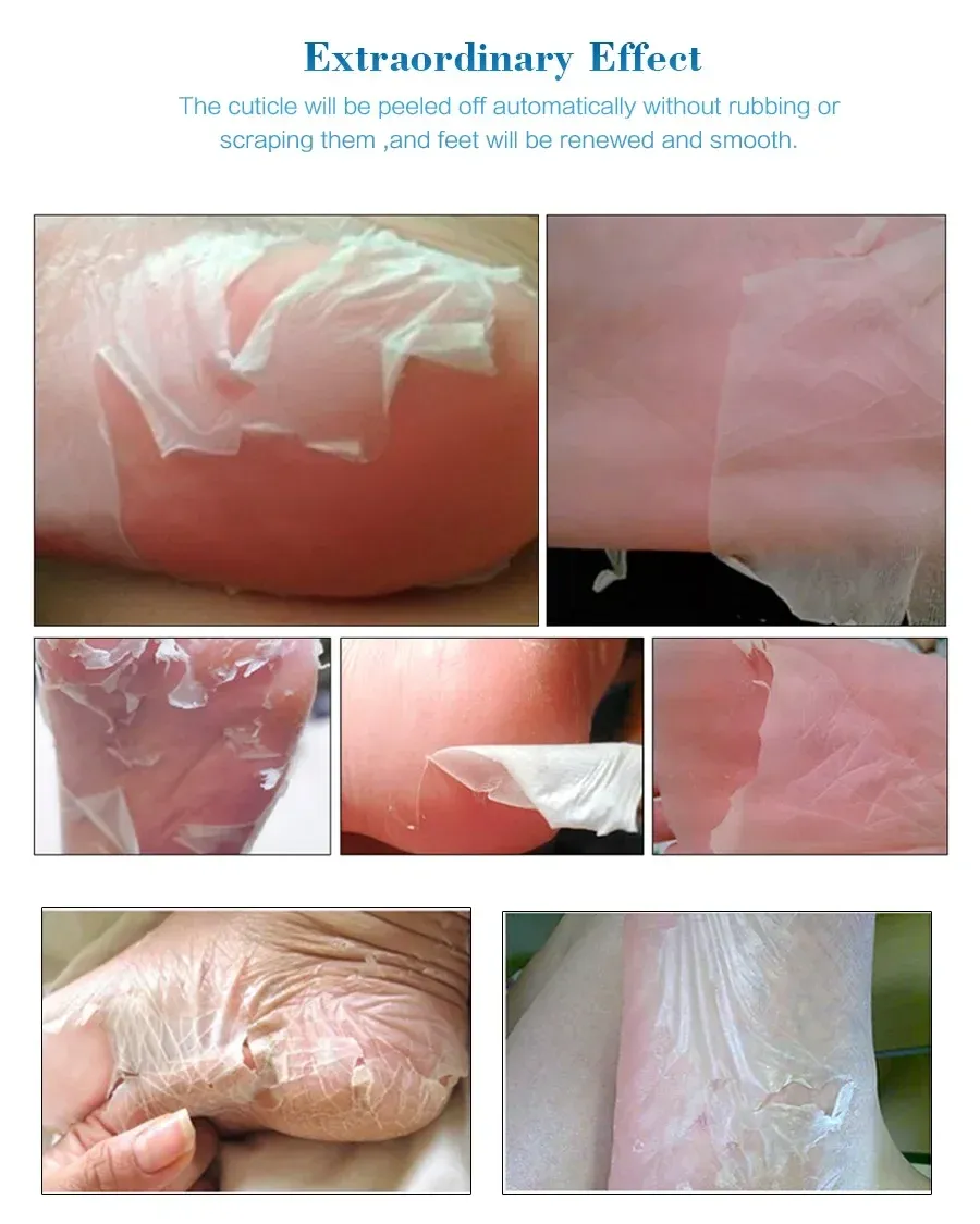 Application du masque sur les pieds
