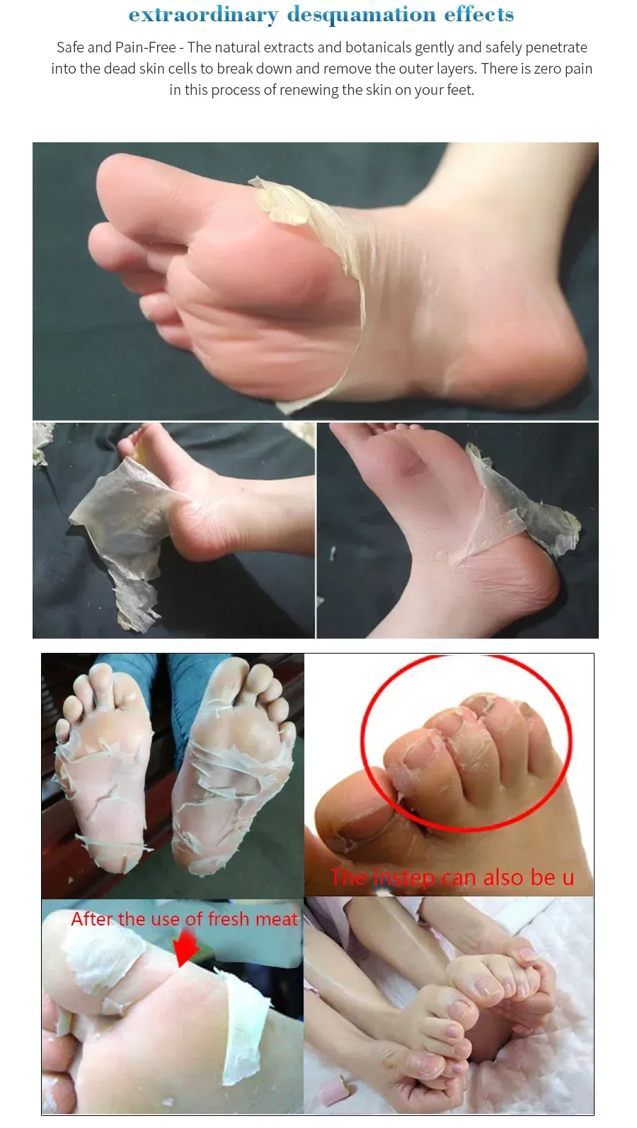 Chaussettes exfoliantes, présentation produit