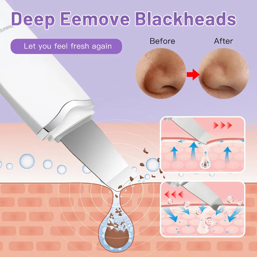 Épurateur de peau électrique à ultrasons avec vibration faciale et spatule 4