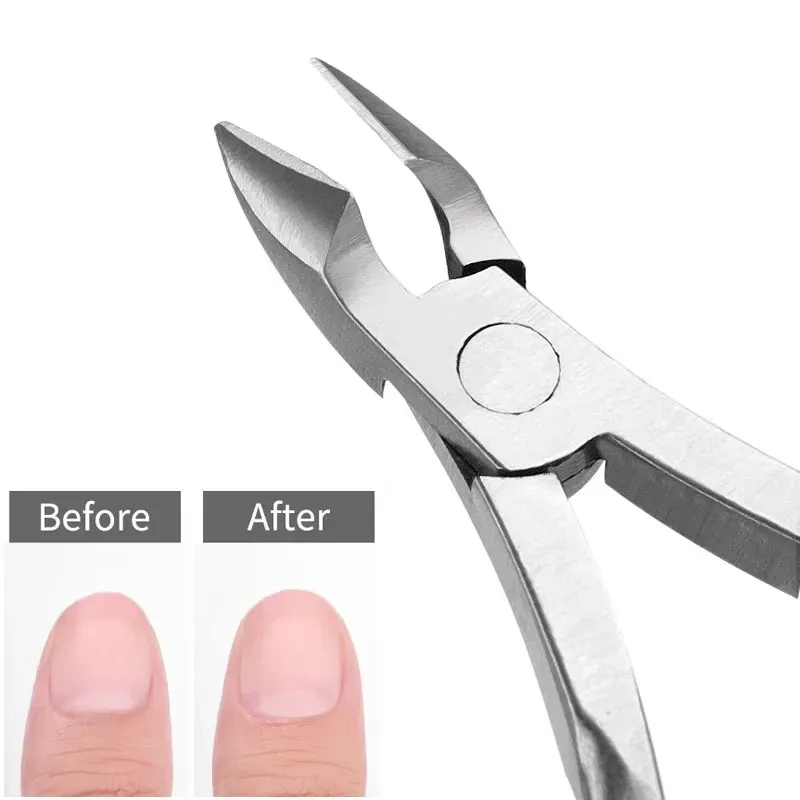 Pince à cuticules professionnelle en acier inoxydable, coupe-ongles, manucure et pédicure, soins, pince coupante, ciseaux de beauté, outils 3