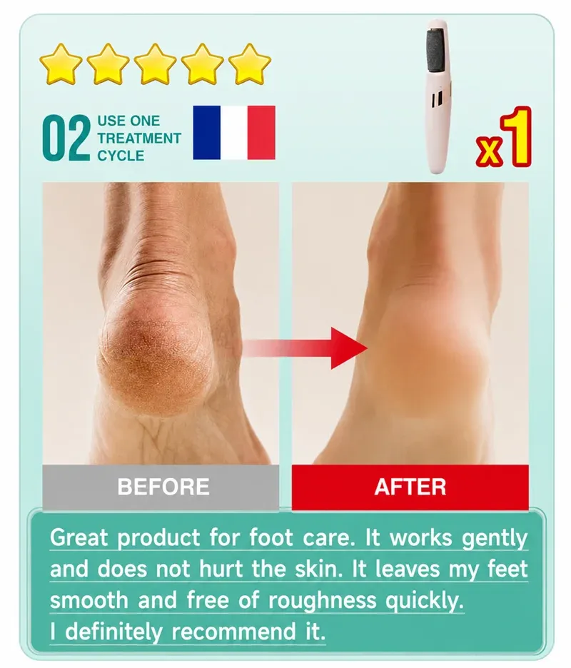 Râpe électrique pour les pieds en utilisation