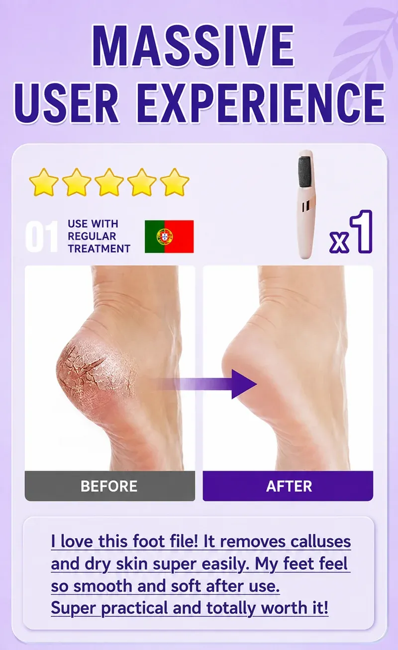 Râpe électrique pour les pieds, vue d'ensemble du design