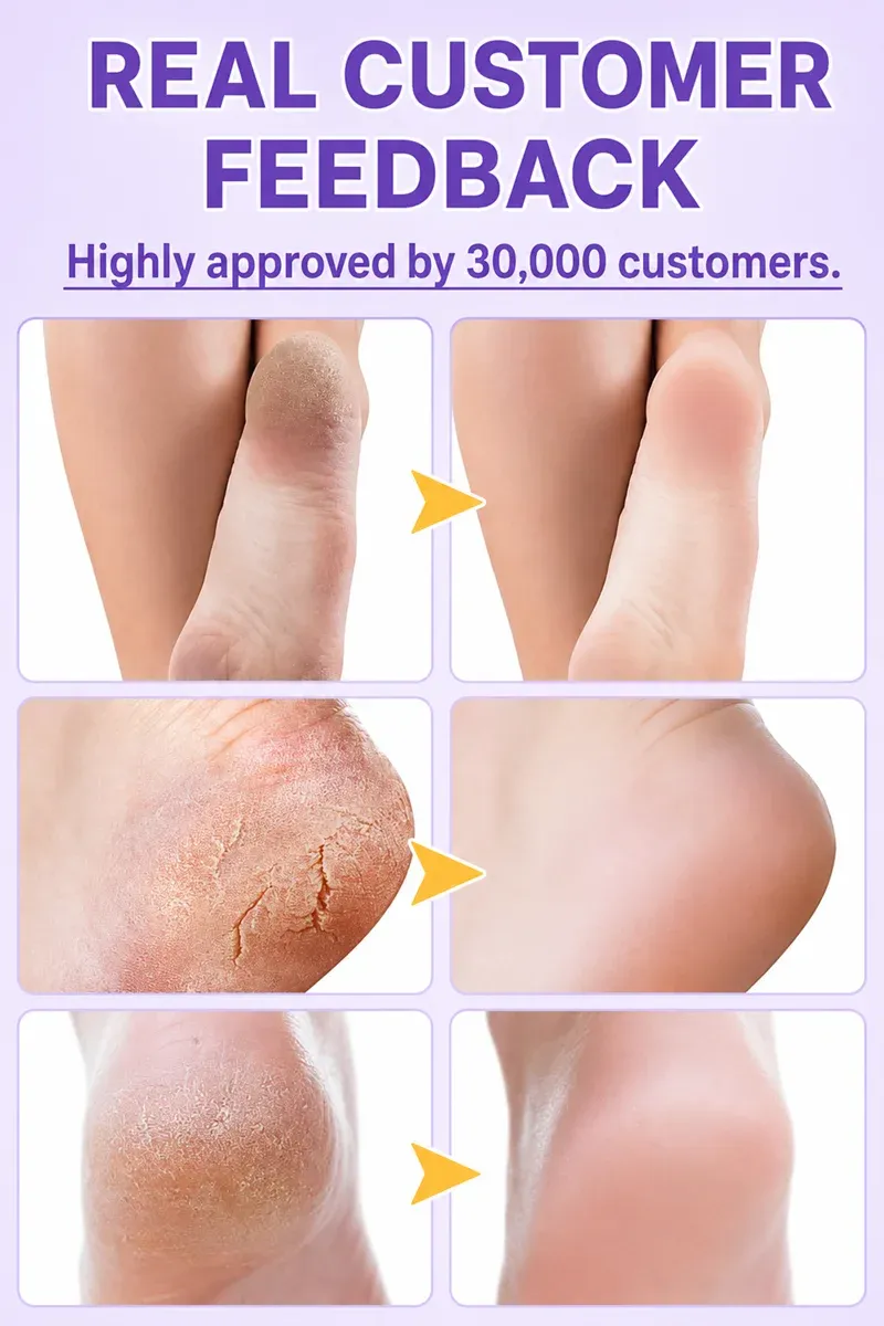 Râpe électrique pour les pieds, usage à domicile