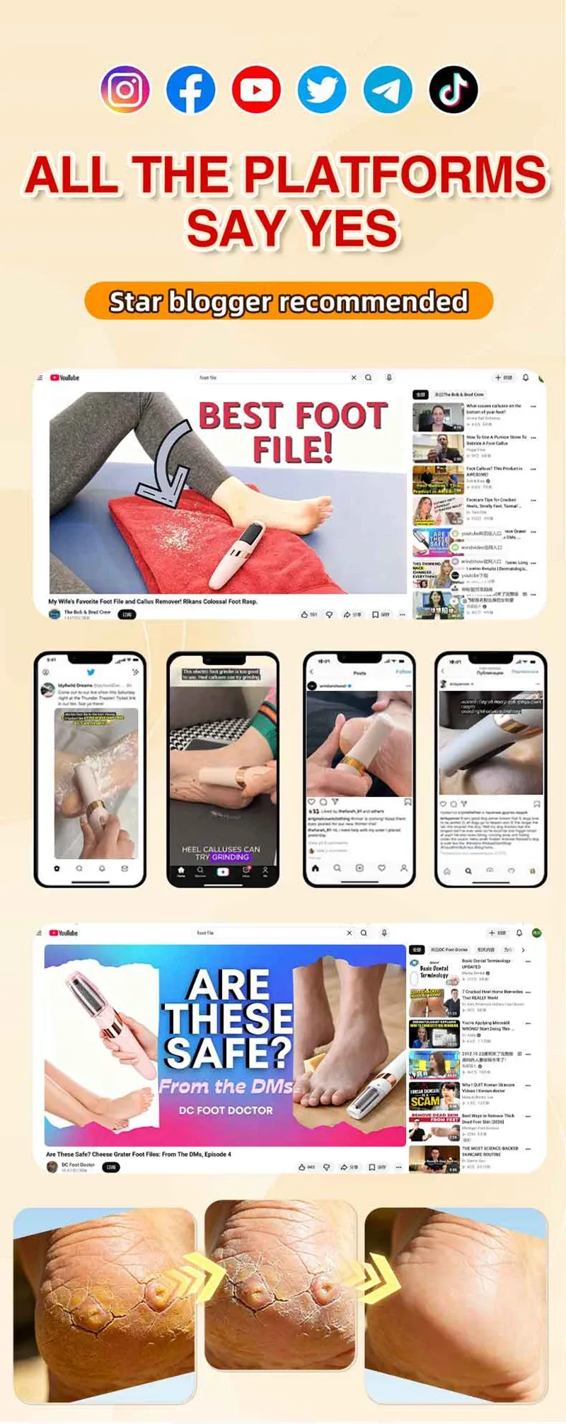 Râpe électrique pour les pieds, présentation complète