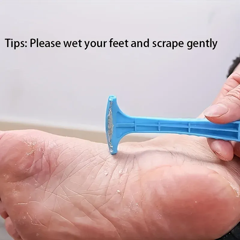 Ensemble de limes à pieds professionnelles, outil d'élimination des callosités, outil d'élimination de la peau à fréquence, pieds lisses 2