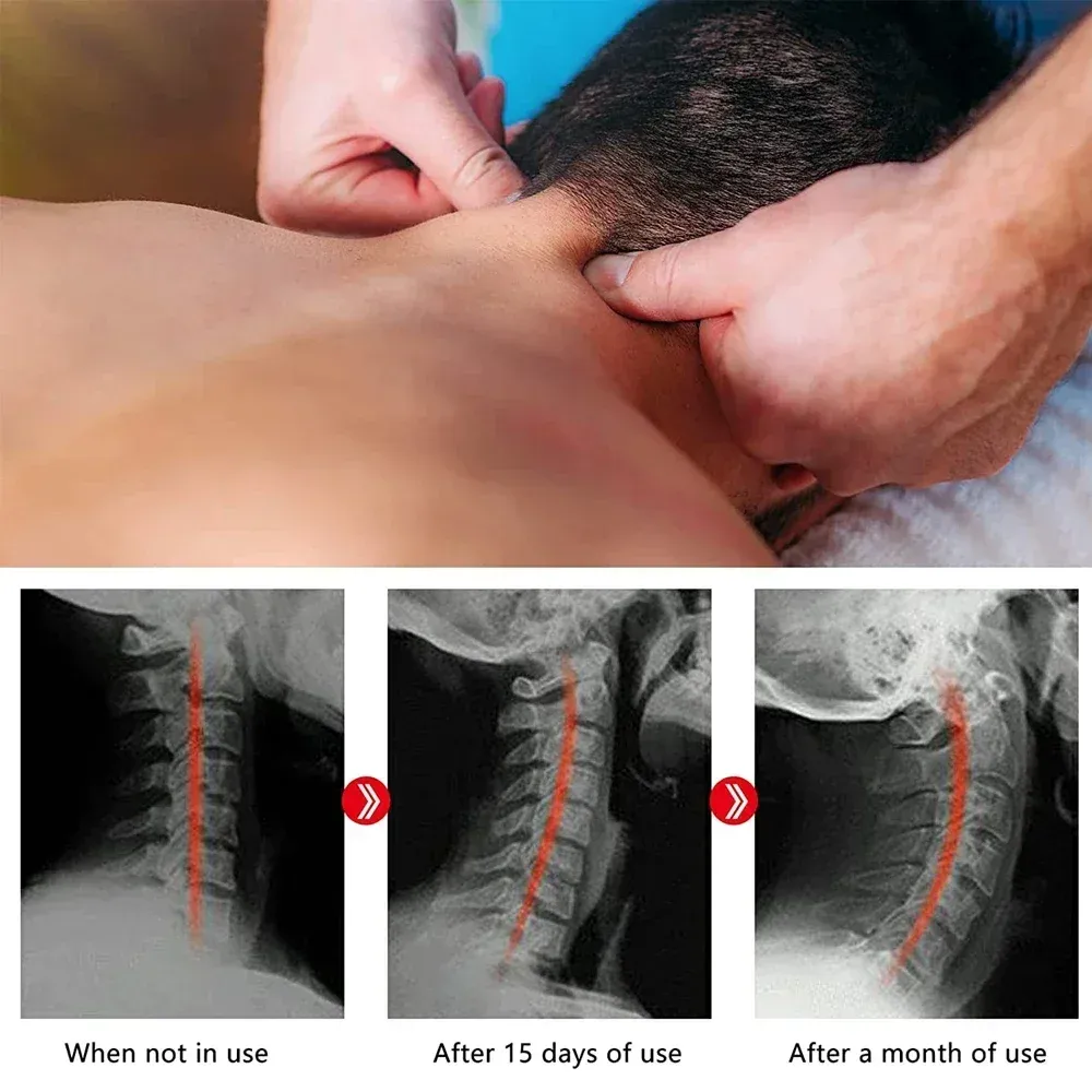 Appareil de traction cervicale pour le cou et les épaules, avec points de massage pour le haut du dos, soulagement de la douleur cervicale et de la colonne vertébrale 4