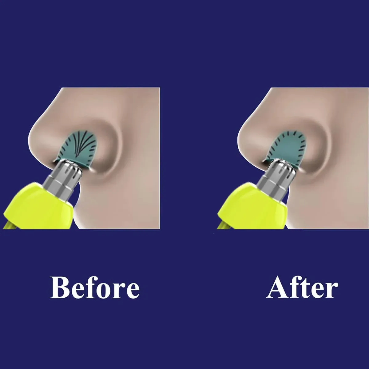 Têtes de rechange pour tondeuse à poils de nez, compatibles avec les lames QP2520, QP2630, QP6510, QP6520 et QP6530, rasoir électrique hybride, nouvelle collection 6