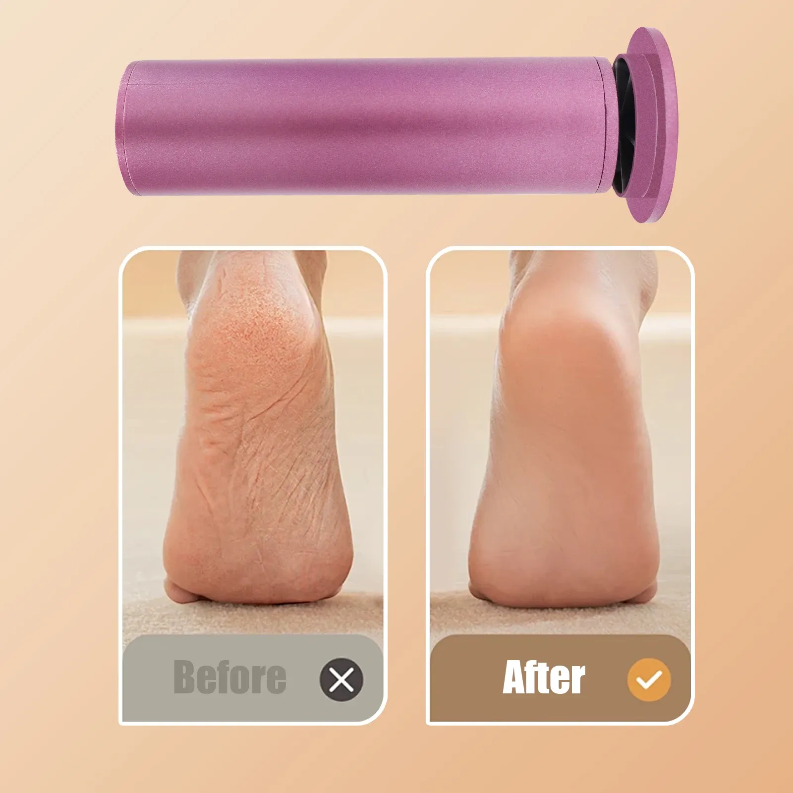 Râpe électrique en utilisation sur les talons