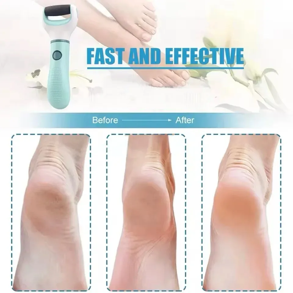 Lime électrique rechargeable et étanche pour pieds, kit de pédicure professionnel pour éliminer callosités et peaux mortes 6