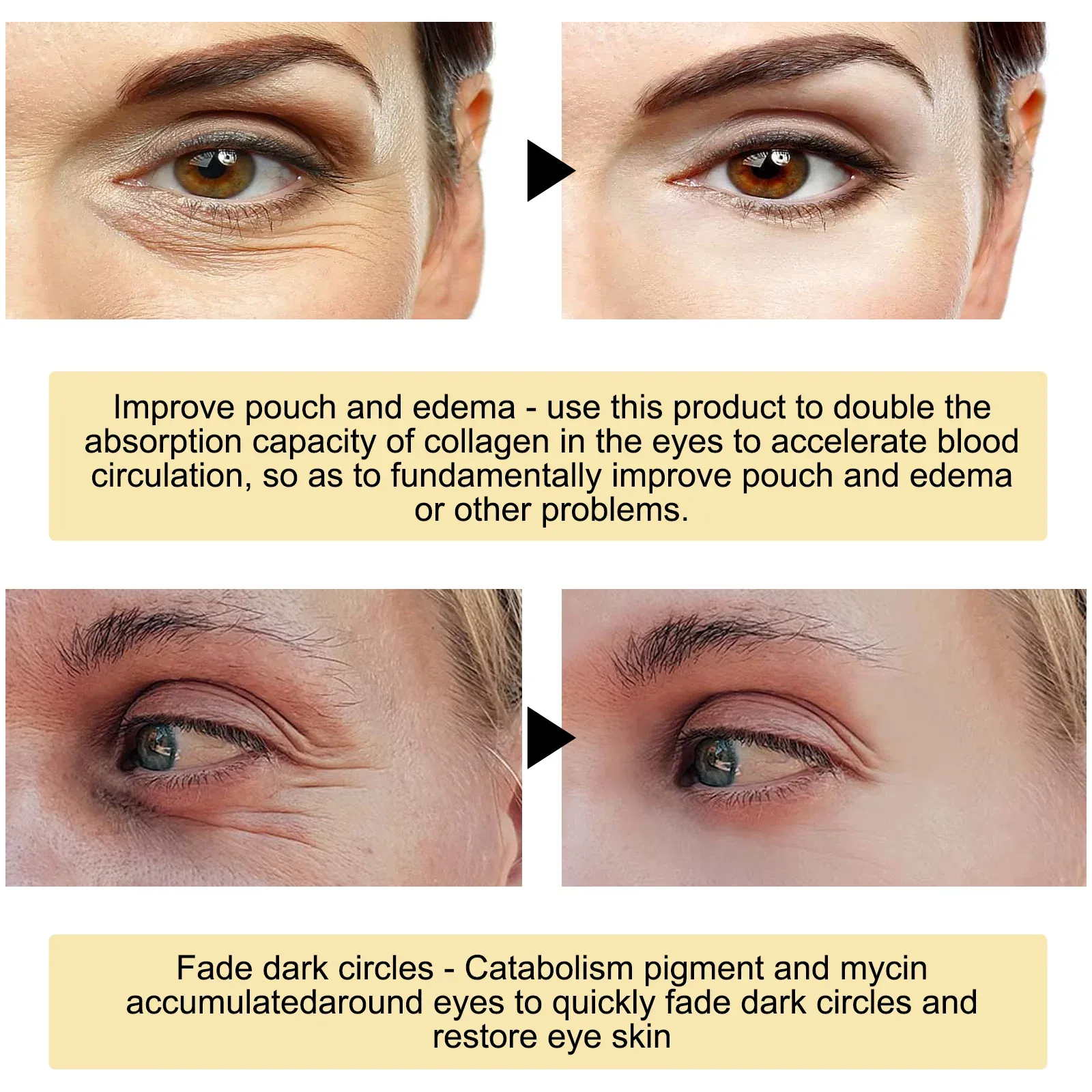 Patchs pour les yeux en situation