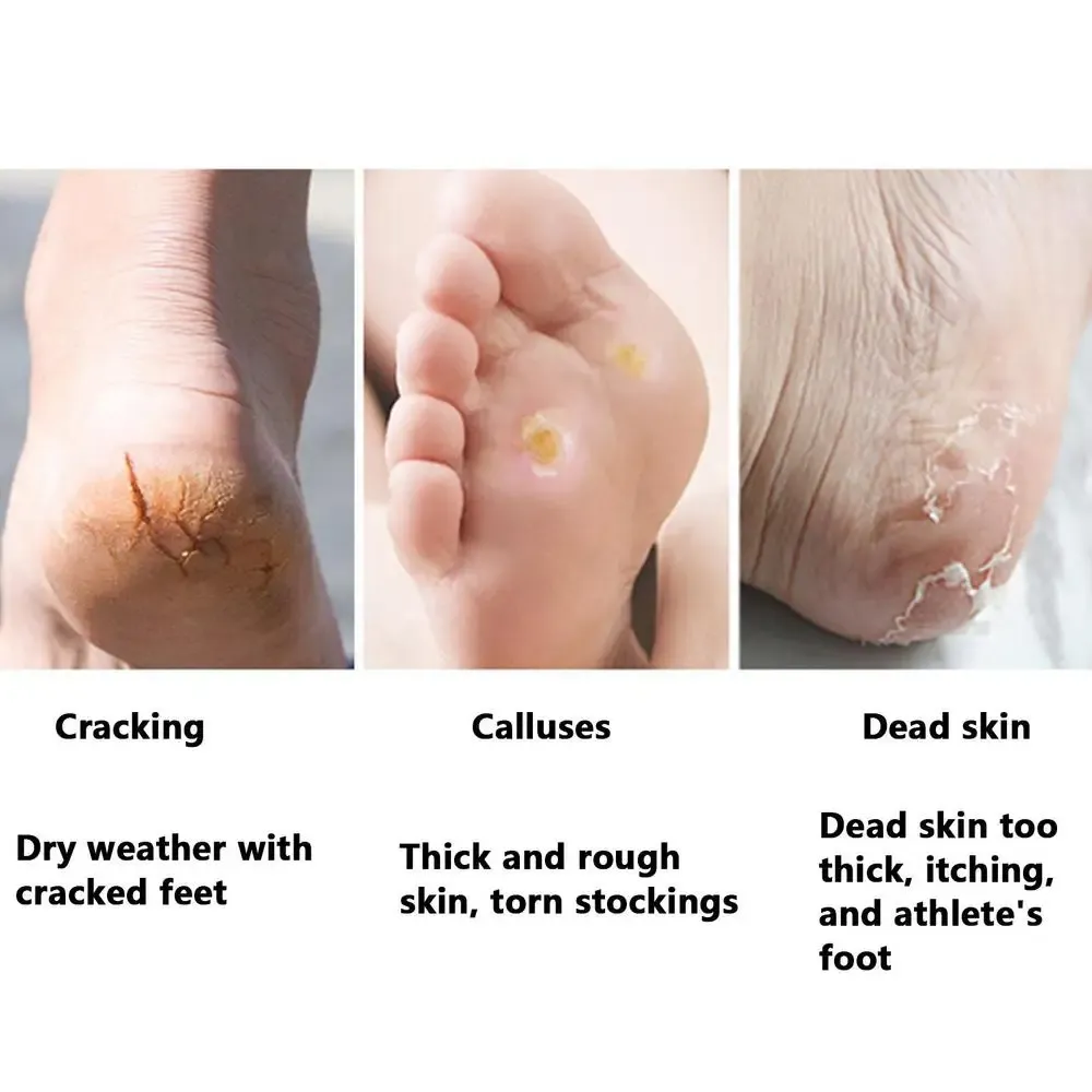 Utilisation de la râpe pour pieds