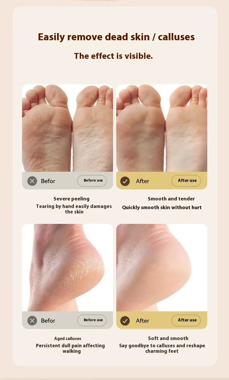 Lime électrique SoftAura pour les pieds