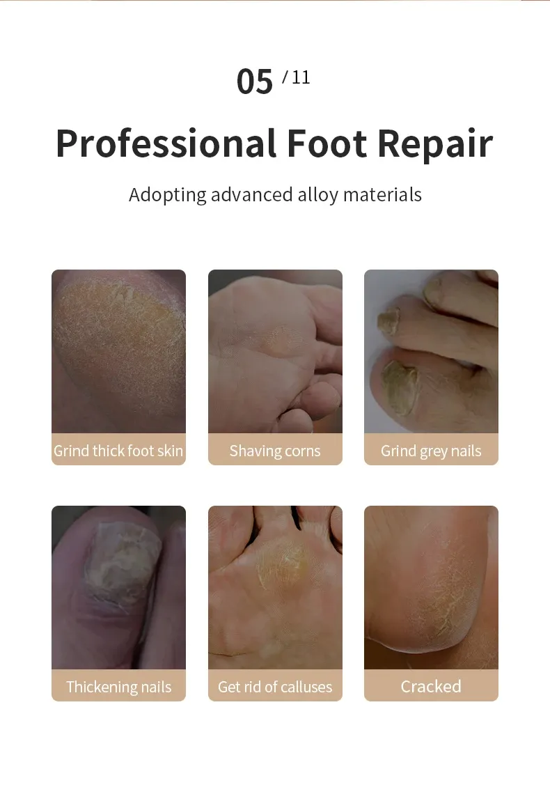 Lime électrique pour pieds, tête de lime