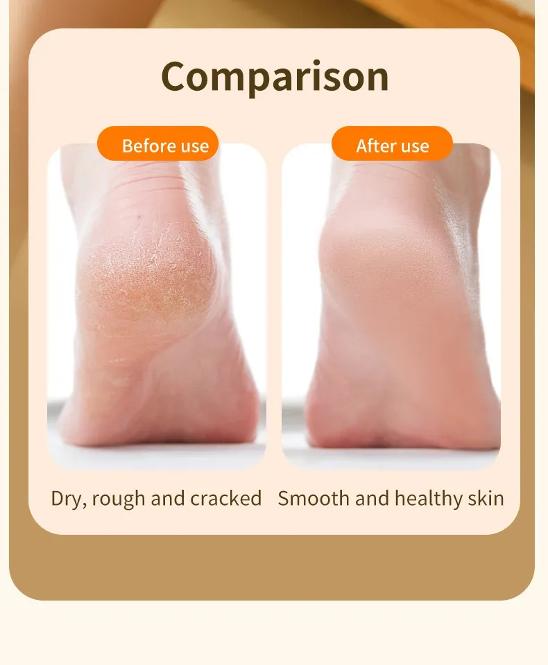 Broyeur de pieds, confort
