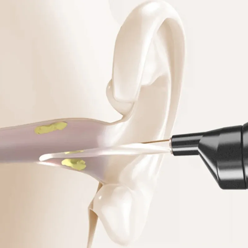 Appareil de nettoyage d'oreille électrique et ses accessoires