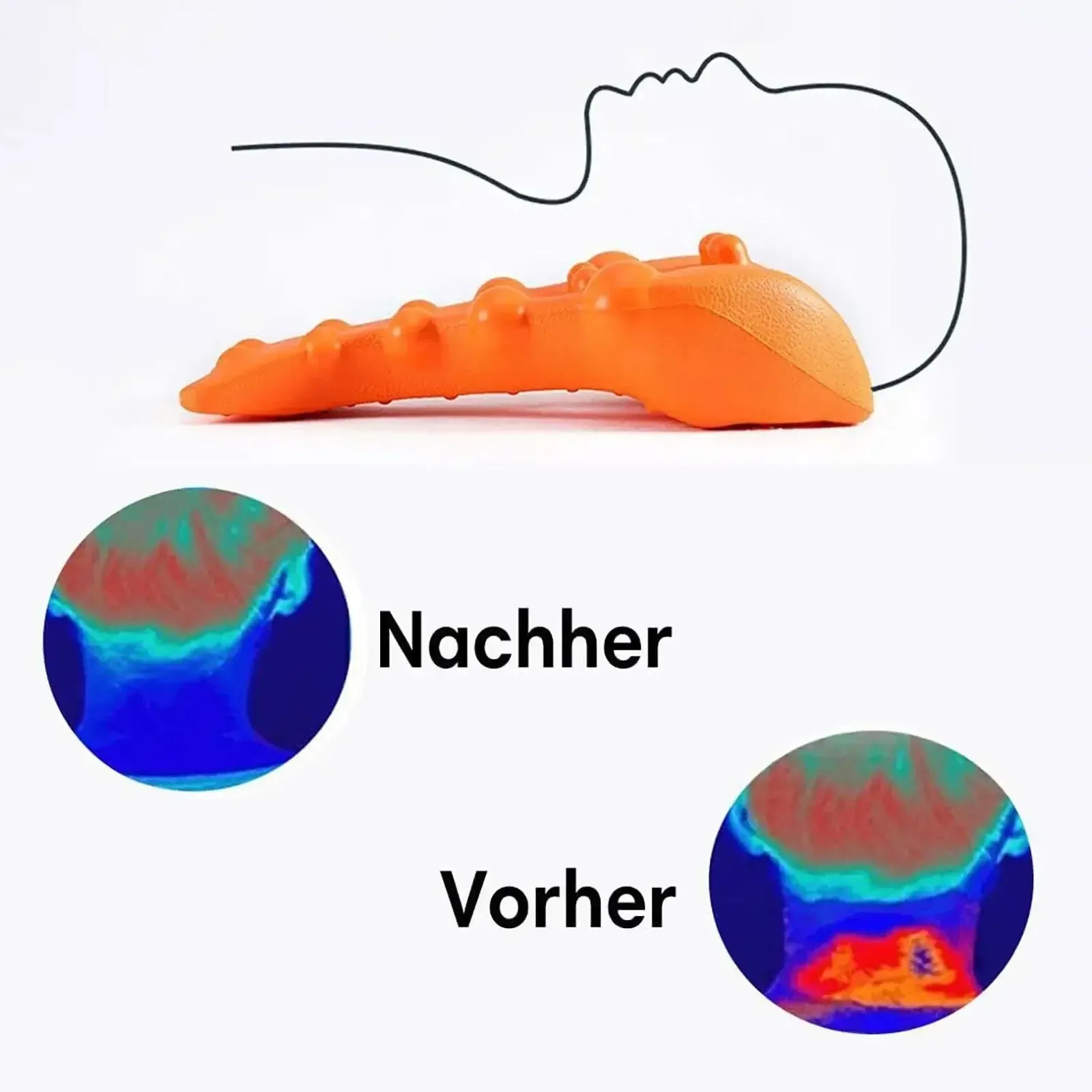 Appareil de traction cervicale sous un autre angle