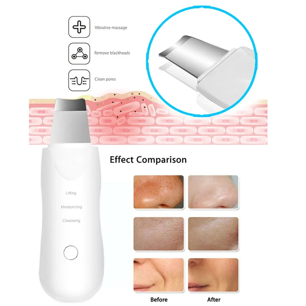 Nettoyeur facial à ultrasons, gros plan